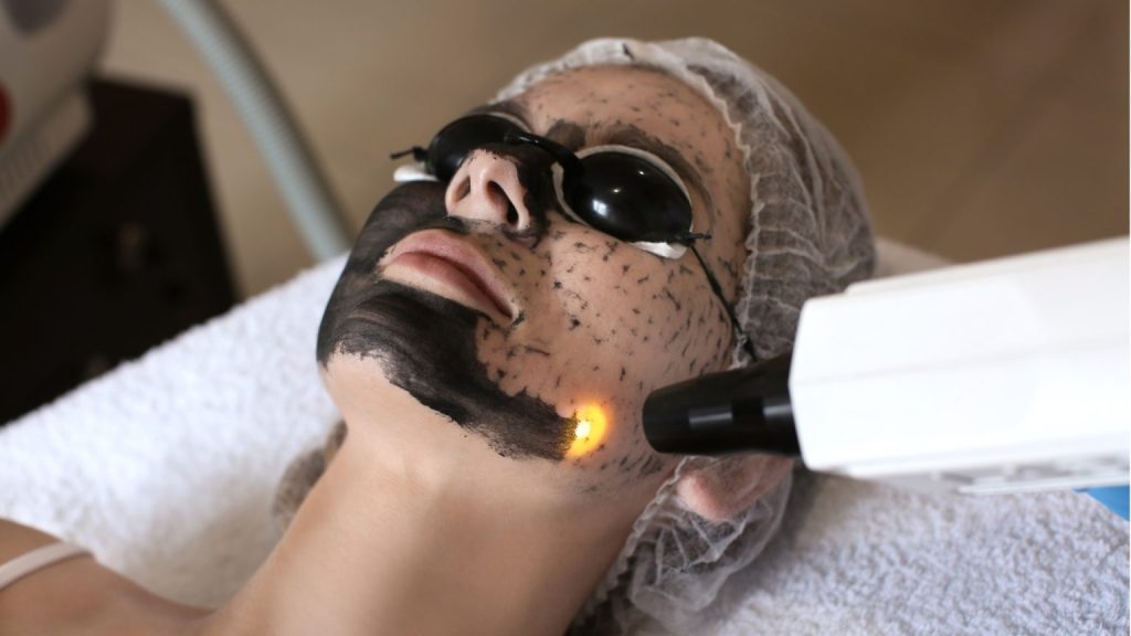 carbon-peeling carbon-peeling-alt